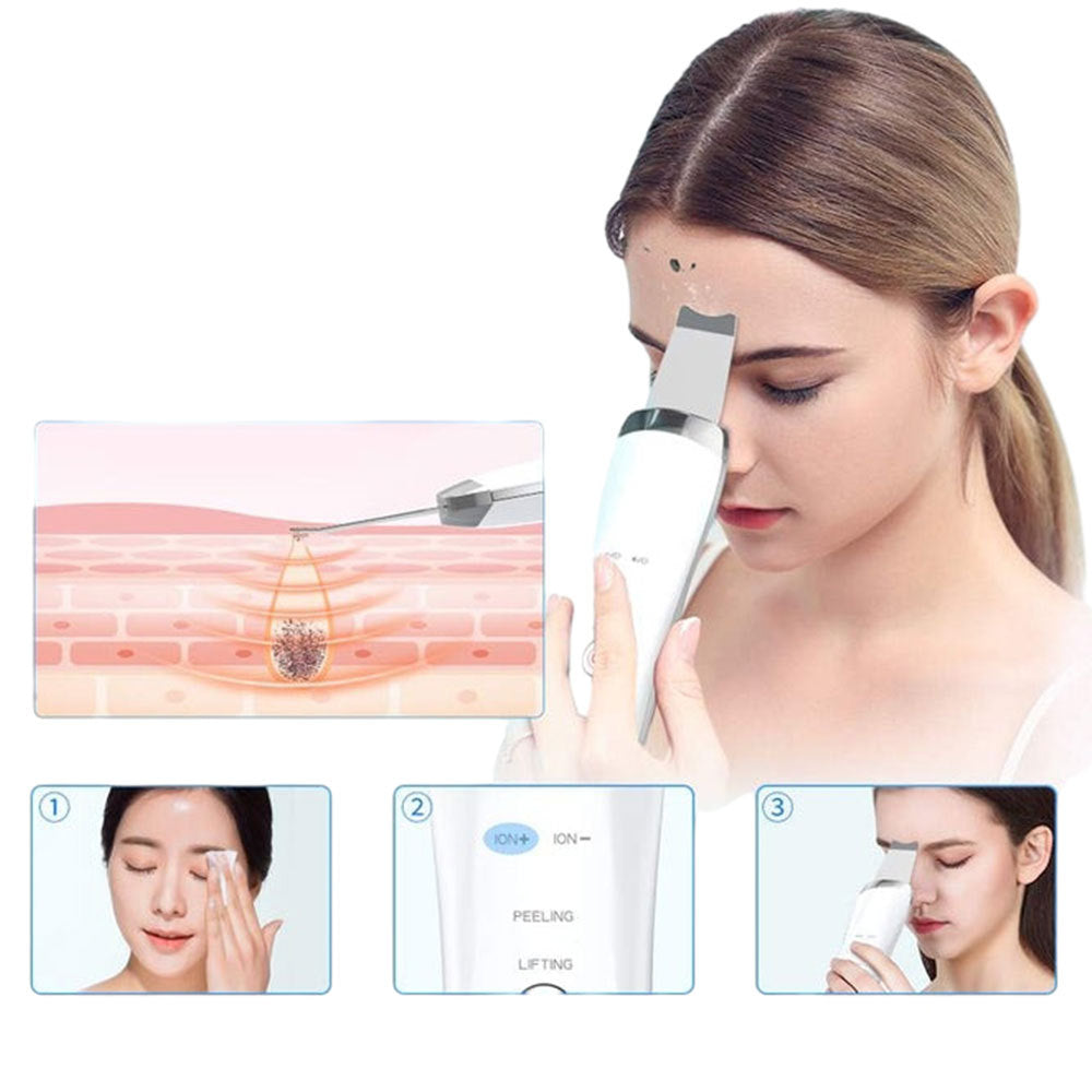 Ultrasonic Skin Scrubber - Deep Facial Cleansing & Blackhead Remover